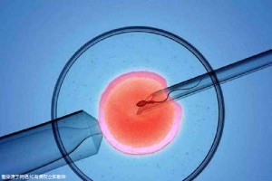 胚胎培养箱